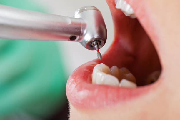 Best Orthodontic Emergency Dentist in Harrison, MI